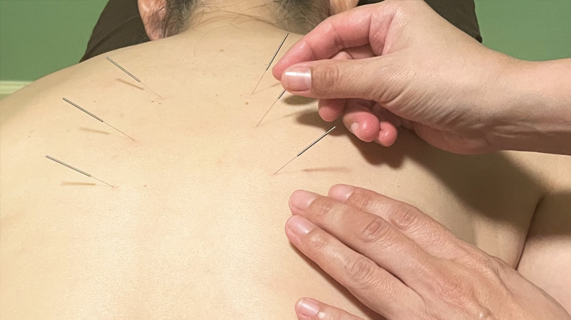 Wellness Treatments ウェルネス トリートメント